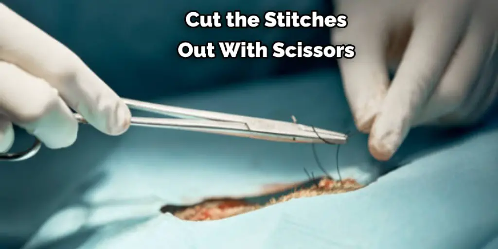 Cut the Stitches Out With Scissors