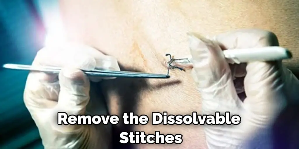 Remove the Dissolvable  Stitches